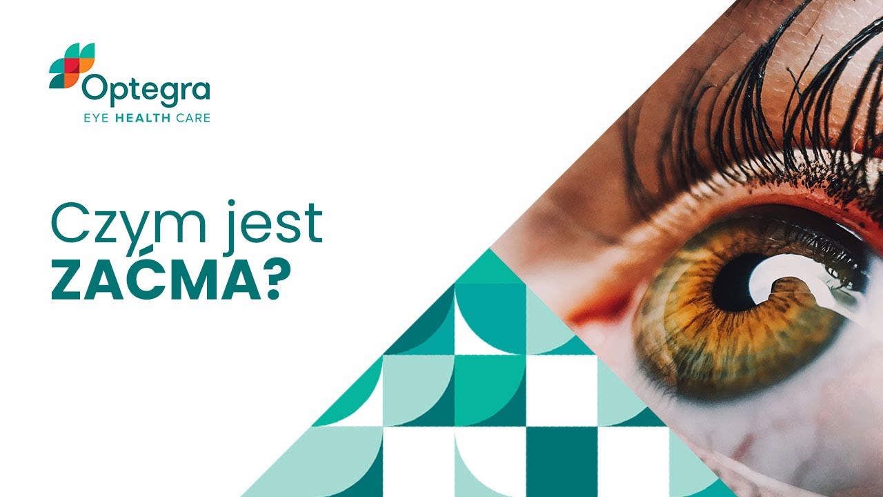 ZAĆMA | Co to jest? W jaki sposób ją leczyć? | Optegra - Centrum Okulistyczne