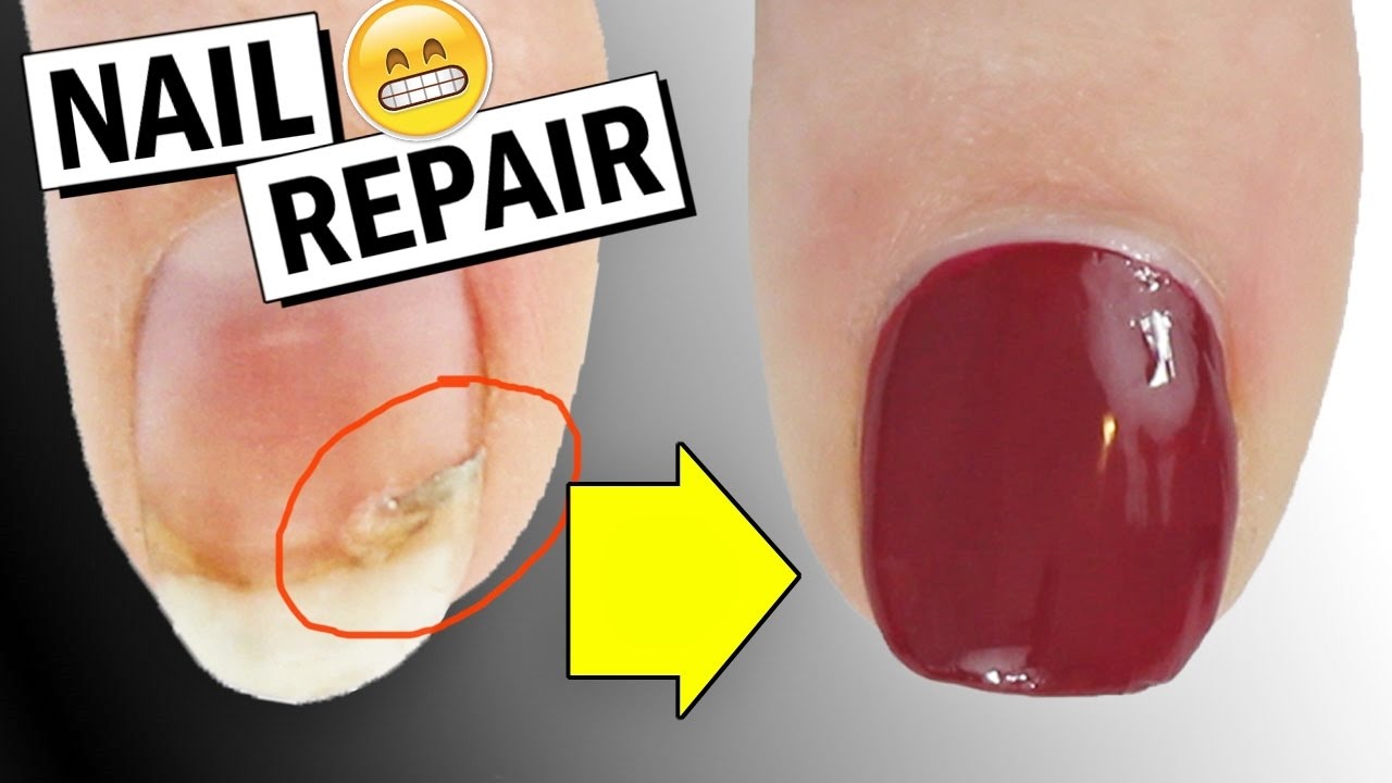HOW TO REPAIR A BROKEN NAIL + DID IT WORK? | Nailed It NZ