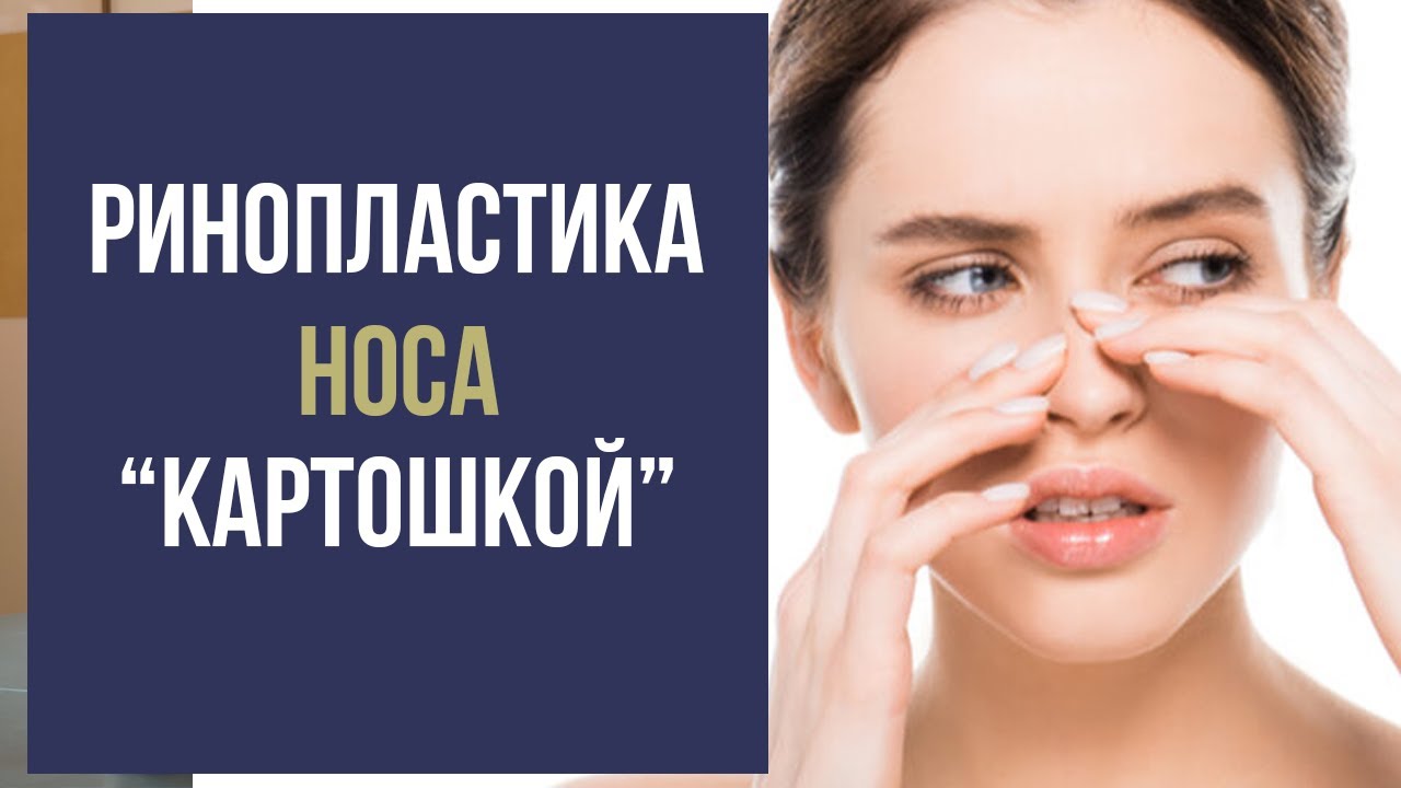 Ринопластика носа 