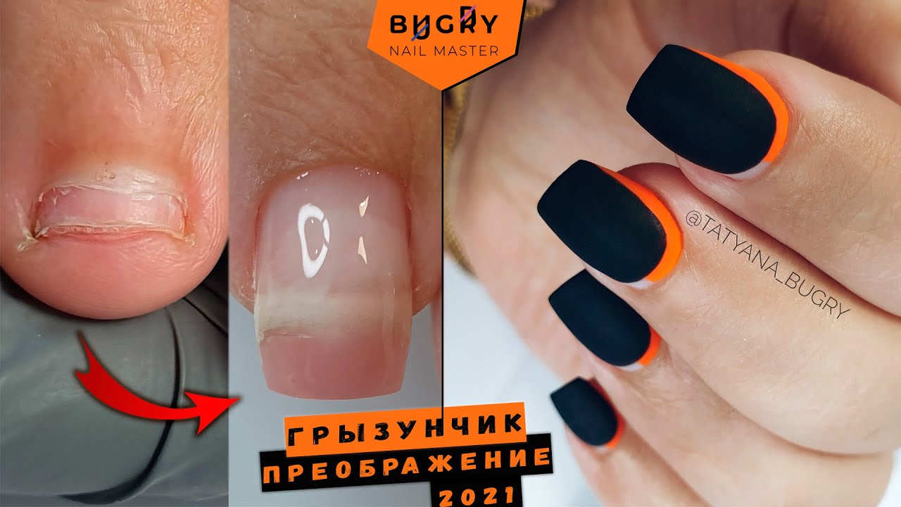 ПРЕОБРАЖЕНИЕ НОГТЕЙ ГРЫЗУНА ЧАСТЬ 3 / НОГОТЬ ПРИРОСТАЕТ / Татьяна Бугрий