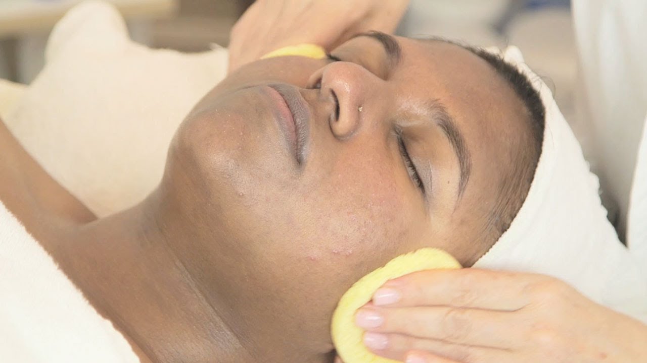 Product & Diet Adjustments for Christina's Acne