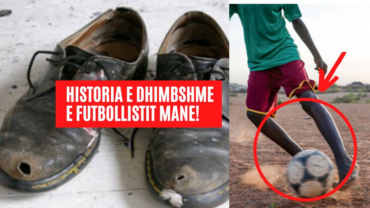 Nga k&euml;mb&euml;zbathur n&euml; milioner, historia e dhimbshme e Mane!