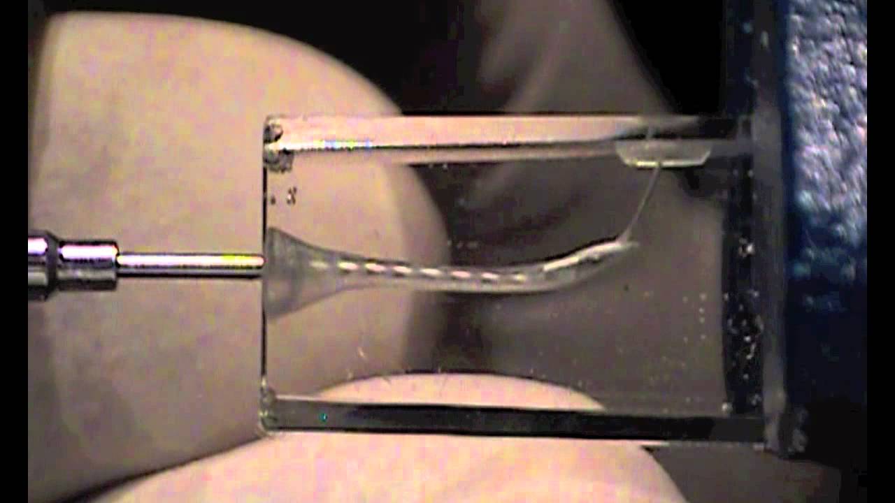 Bypassing a Fractured Gates Glidden with Endurance Limit Concept