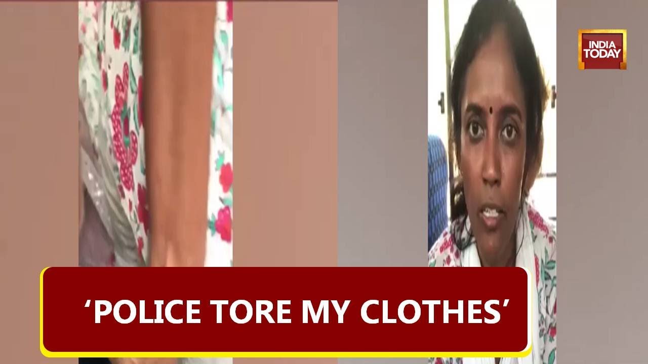 Congress MP Alleges Brutality By Delhi Police, Shows Torn Clothes In Video Addressed To Om Birla