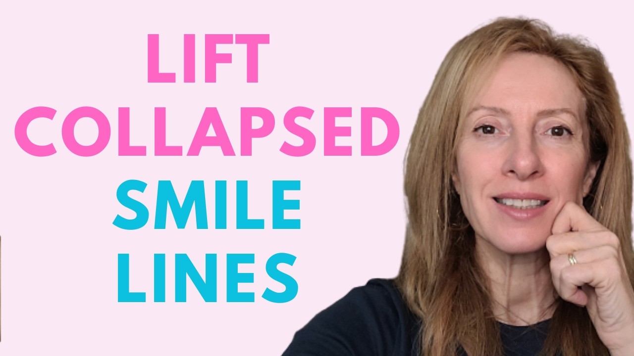 Why Smile Lines Collapse the Mid-Face — How to Lift Naturally (50+) ✨🌿