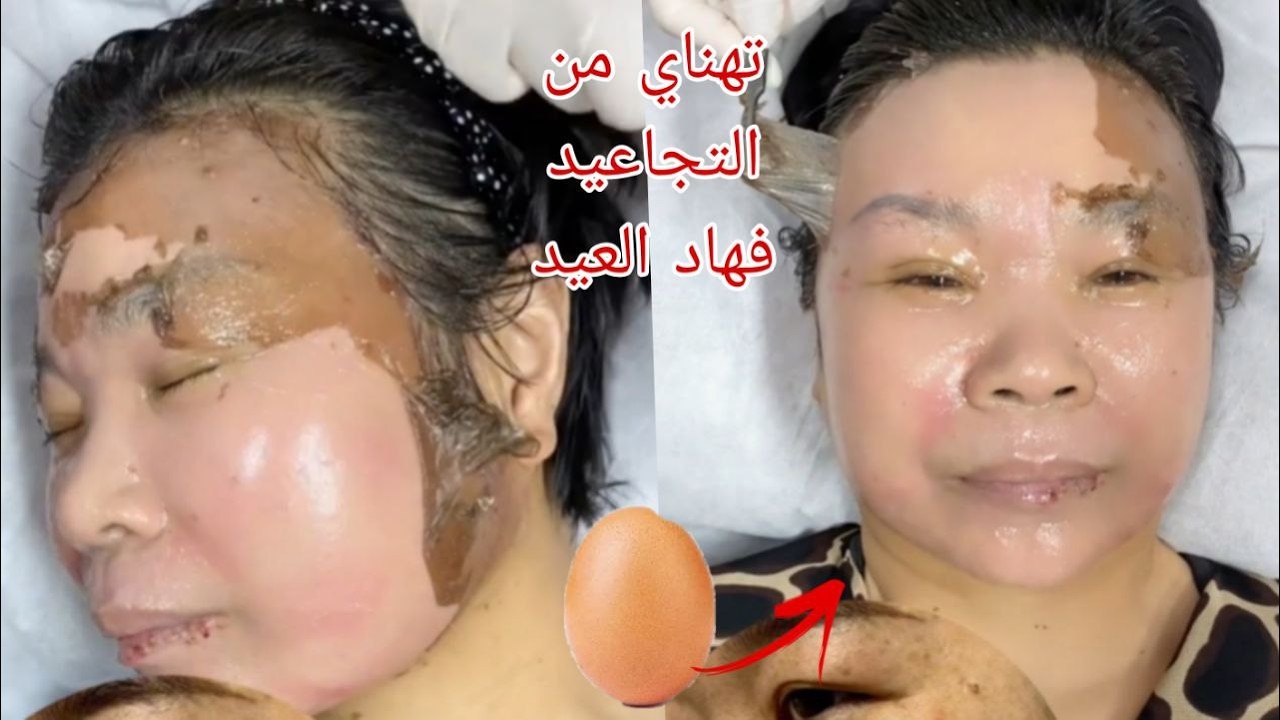 أقسم بالله بيضة واحدة ستخلصك من التجاعيد الرؤوس السوداء والبيضاء غادي تردلك وجهك مرايا مجربة ومضمونة