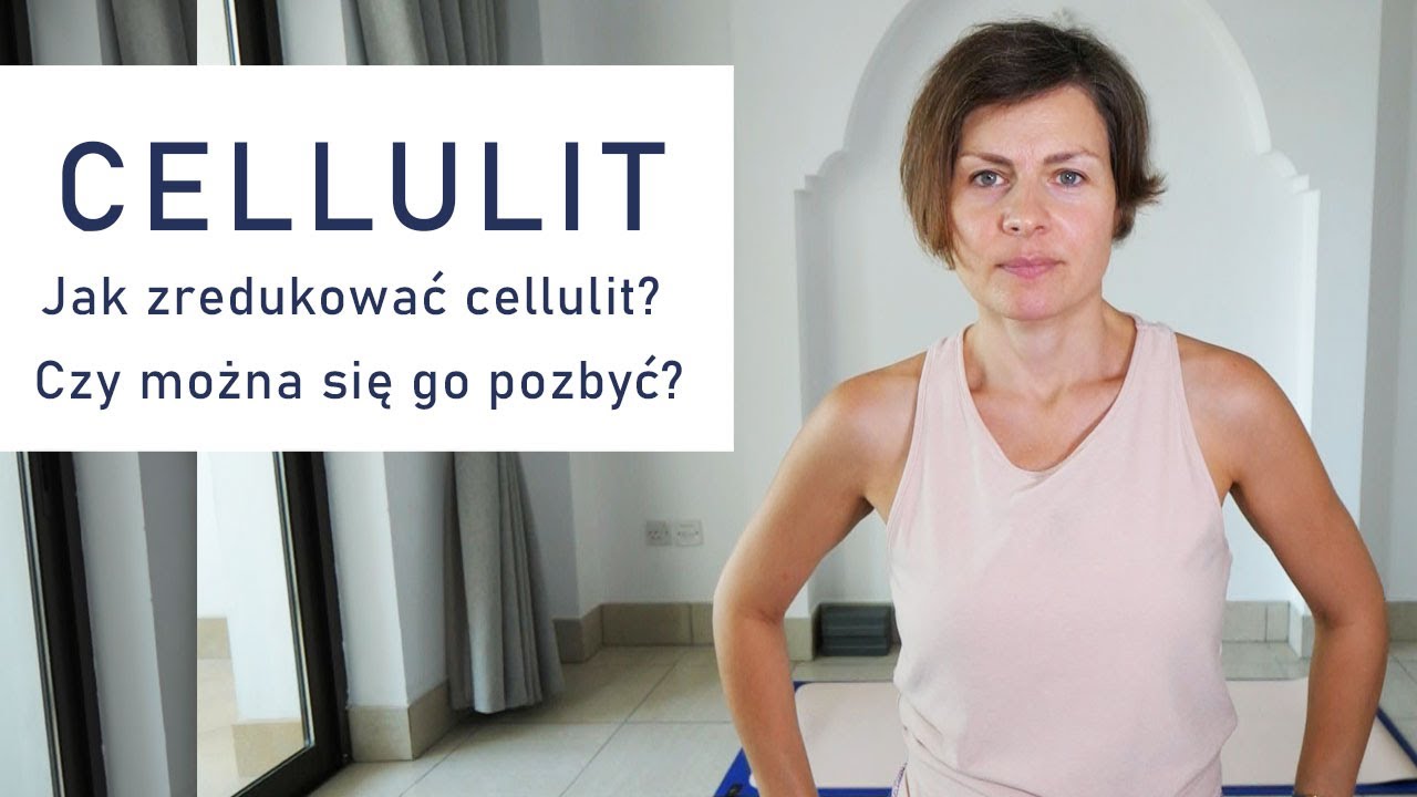 Zaczęłam Walkę z Cellulitem – Ćwiczenia, Nadzieje i Rozczarowania | Moje Pierwsze Próby
