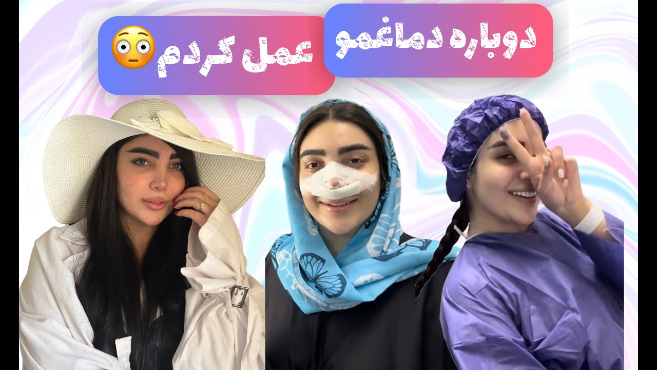 دوباره دماغمو عمل کردم 😲