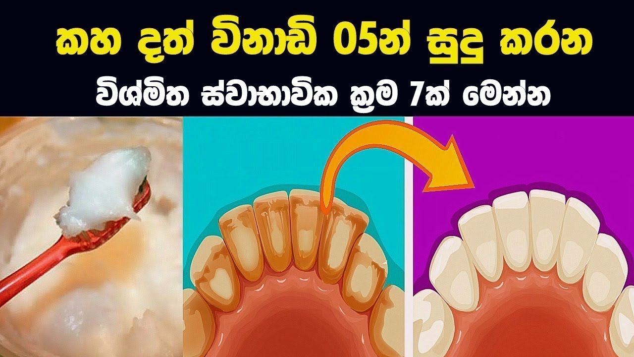 කහ දත් විනාඩි 05න් සුදු කරන ස්වාභාවික ක්‍රම 07ක් - 07 Secrets to Whiter Teeth