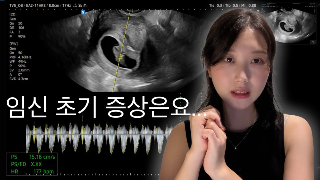 임신 초기 증상? 출근하다 쓰러짐..💫 | 퇴사와 결혼을 결심한 이유