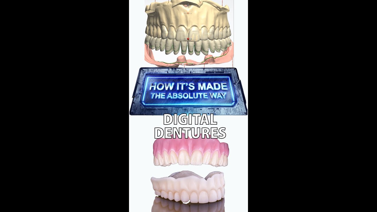 How a Digital Denture is Made!