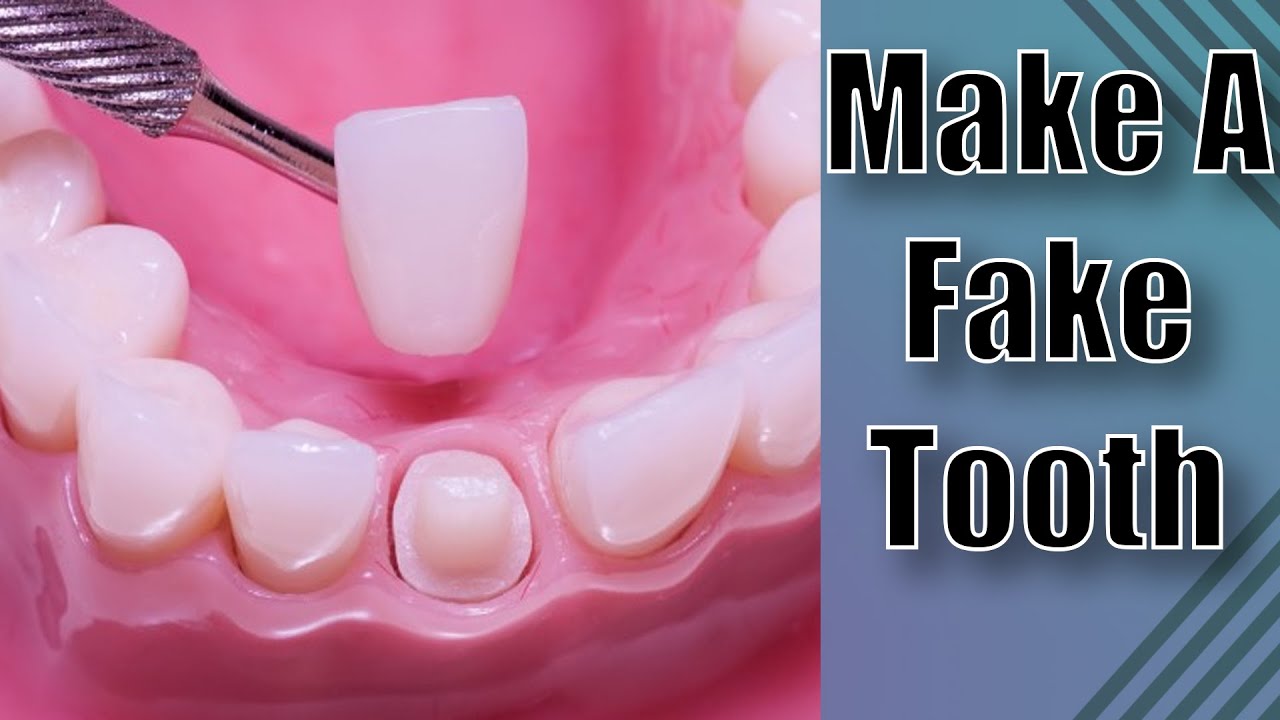 Dental Temporary Crowns - Front Tooth Crowns