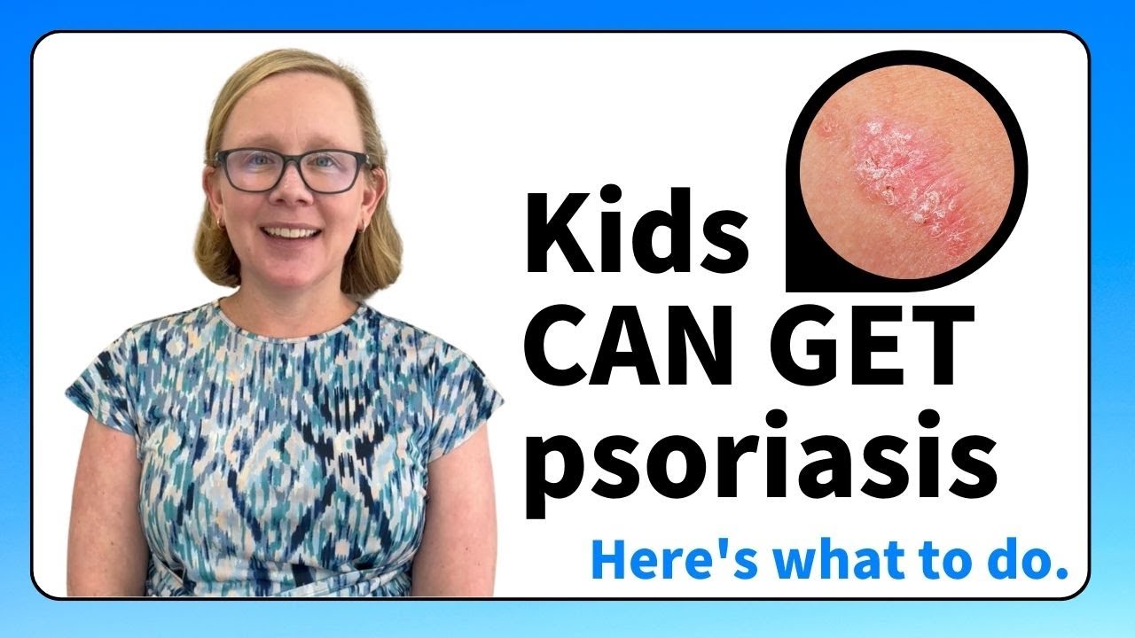 Yes, kids CAN get psoriasis, and here's what we can do about it