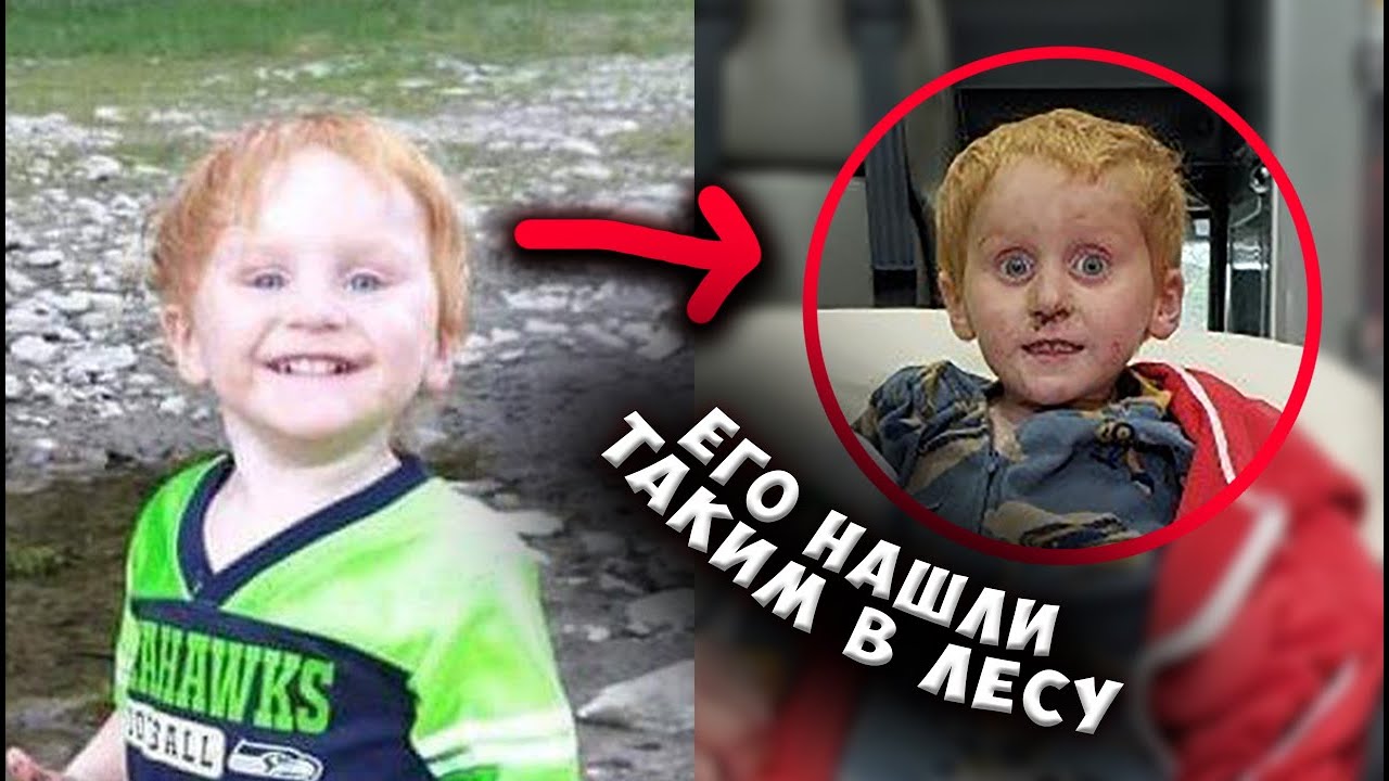 ОН НА ДВА ДНЯ ПРОПАЛ В ЛЕСУ И ЕГО НАШЛИ ТАКИМ
