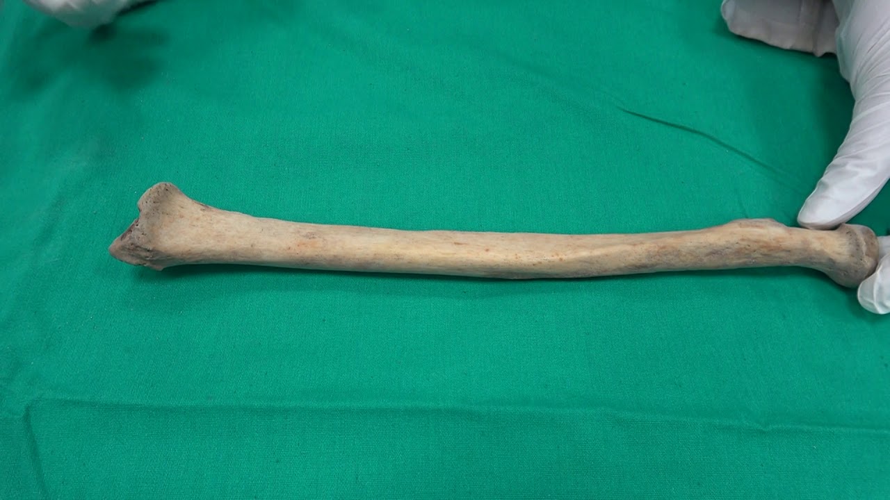 Anatomi Kemikler-Üst Ekstremite Kemikleri- Os Radius Anatomisi (kemikler anatomi)