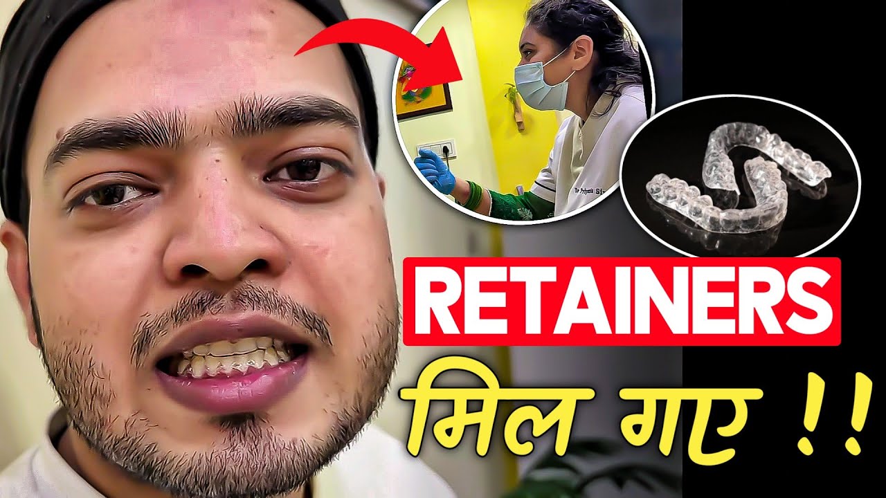 Retainers Delivery Vlog | Finally Retainers Lag Gaye  | #retainers #braces 