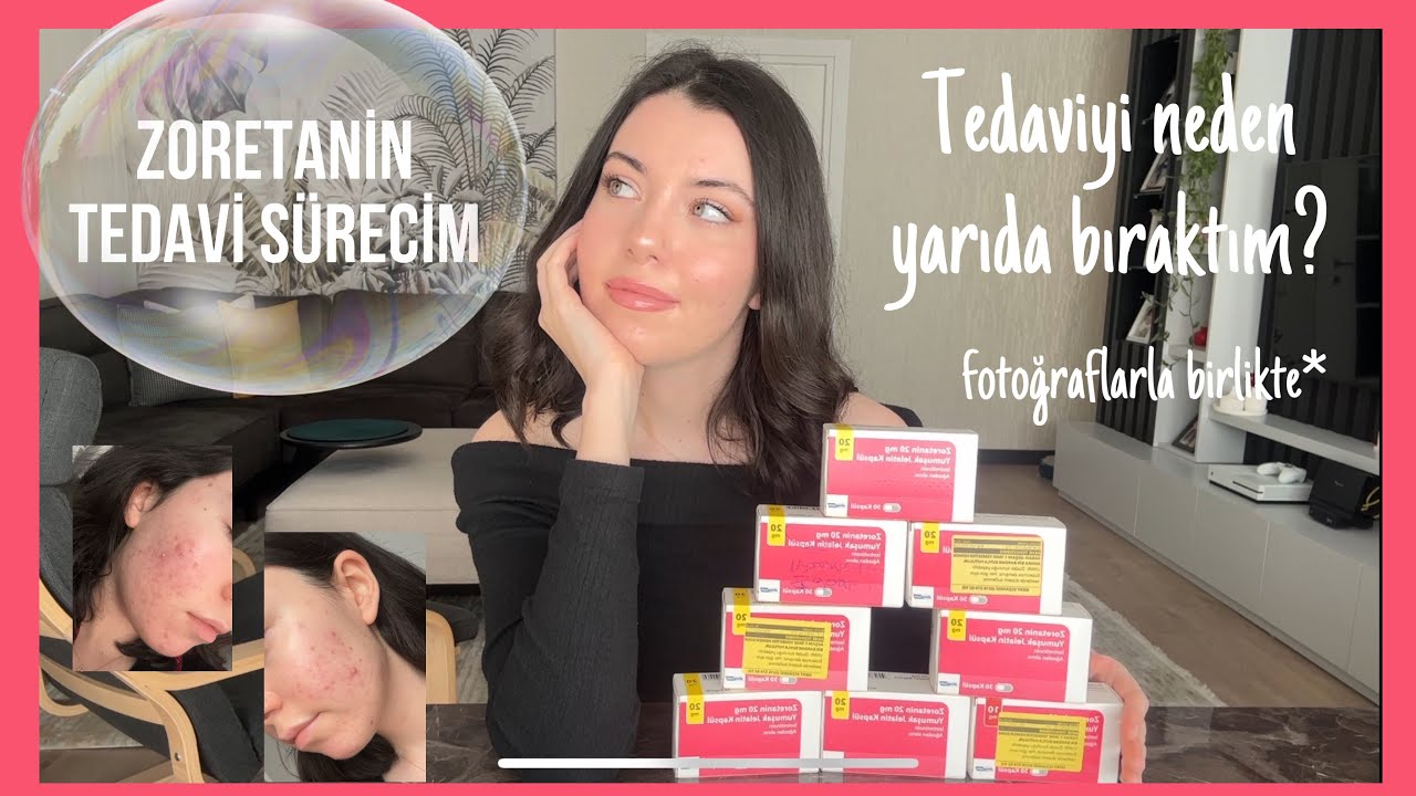 ZORETANİN TEDAVİ SÜRECİM💊 | Tedaviyi neden yarıda bıraktım? Yan etkileri nasıldı?