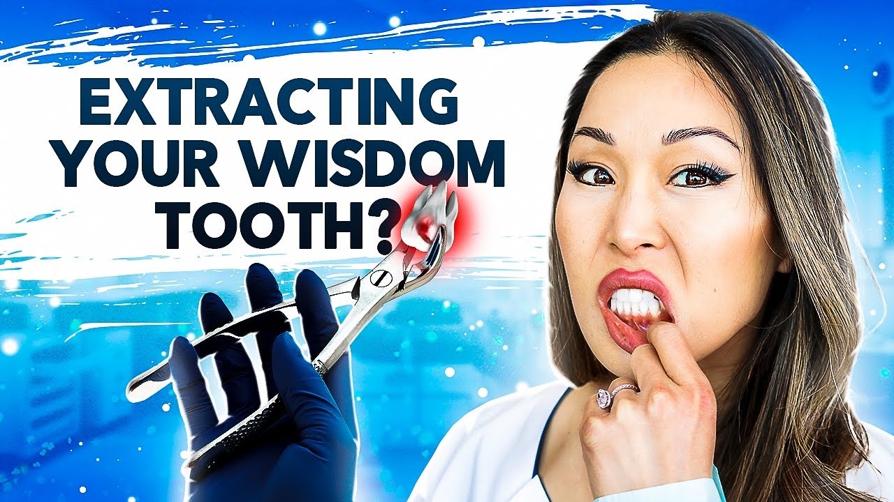 Do You Need To Extract Your Wisdom Teeth - Reasons To keep Them
