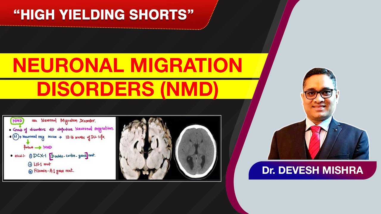 High Yielding Shorts-85 (#HYS-85): Neuronal Migration Disorders (NMD) by Dr Devesh Mishra