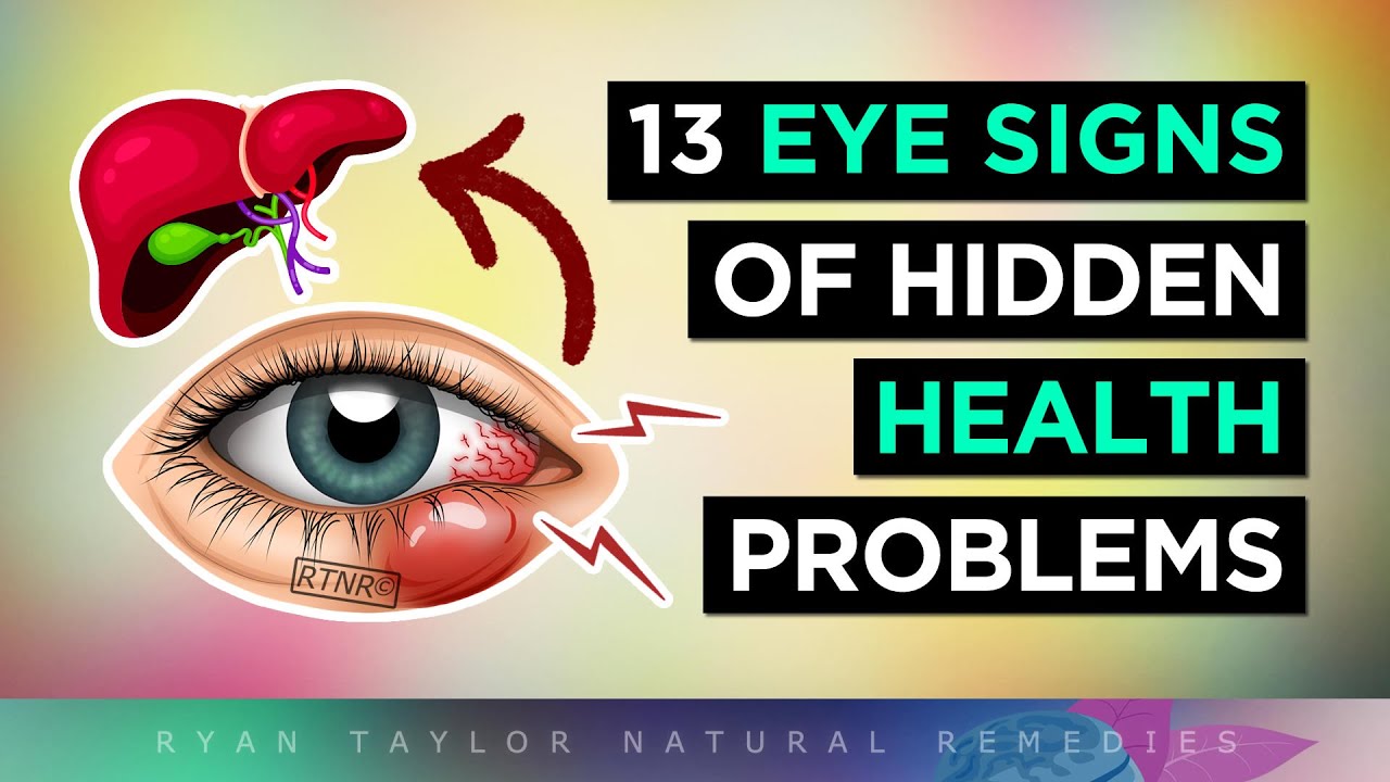 13 Eye Signs of HIDDEN Health Problems