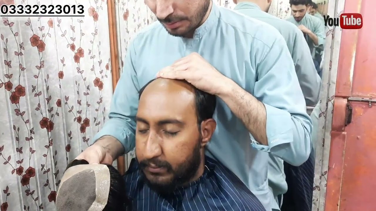 Natural looking hair patch in Quetta ]Non surgical hair Replacement