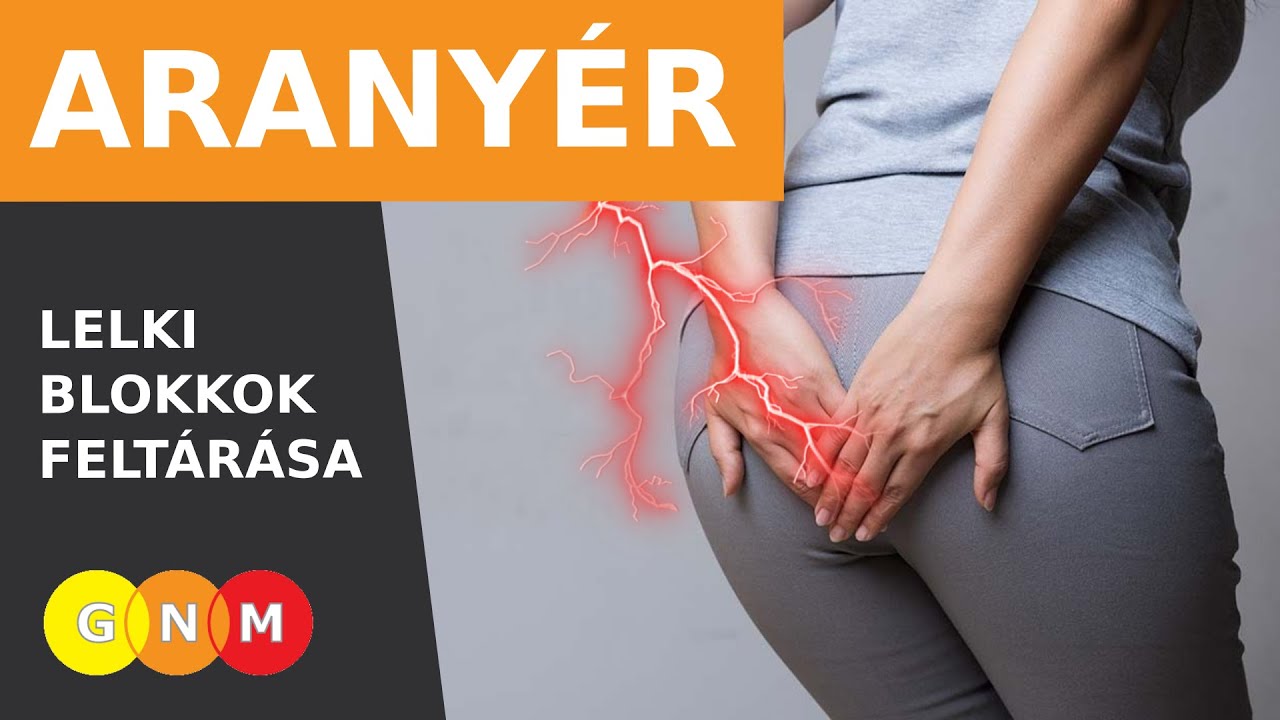 Az arany&eacute;r (hemorrhoid) lelki okai a Germ&aacute;n Gy&oacute;gytudom&aacute;ny &eacute;s a Recall Healing t&uuml;kr&eacute;ben