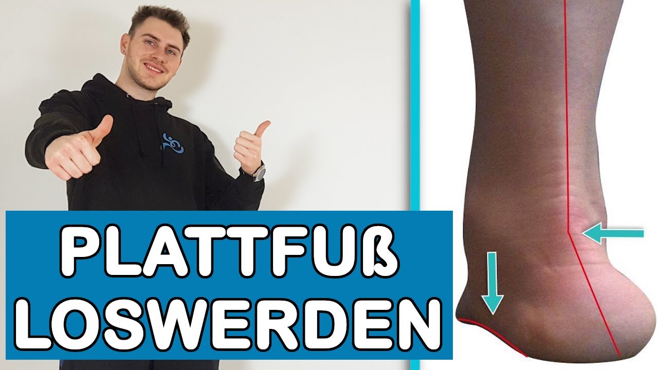 Knick-Senk-Spreizfuß (Plattfuß) | Übungen für zu Hause