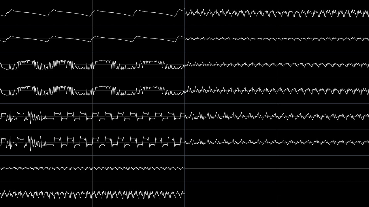 Winter Gold - Menu [Oscilloscope Visualization]