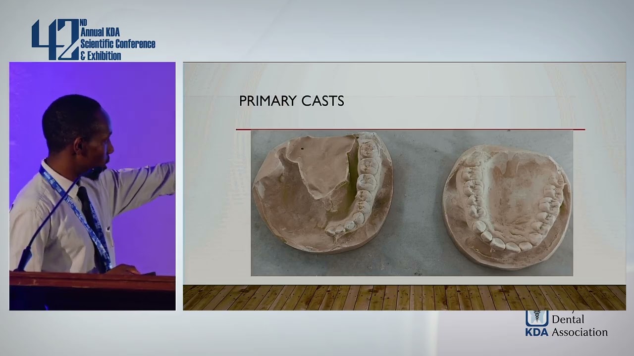 Case Report for Removable Cobalt Chrome Maxillofacial Prosthesis By Peter Muchina (Moi University)