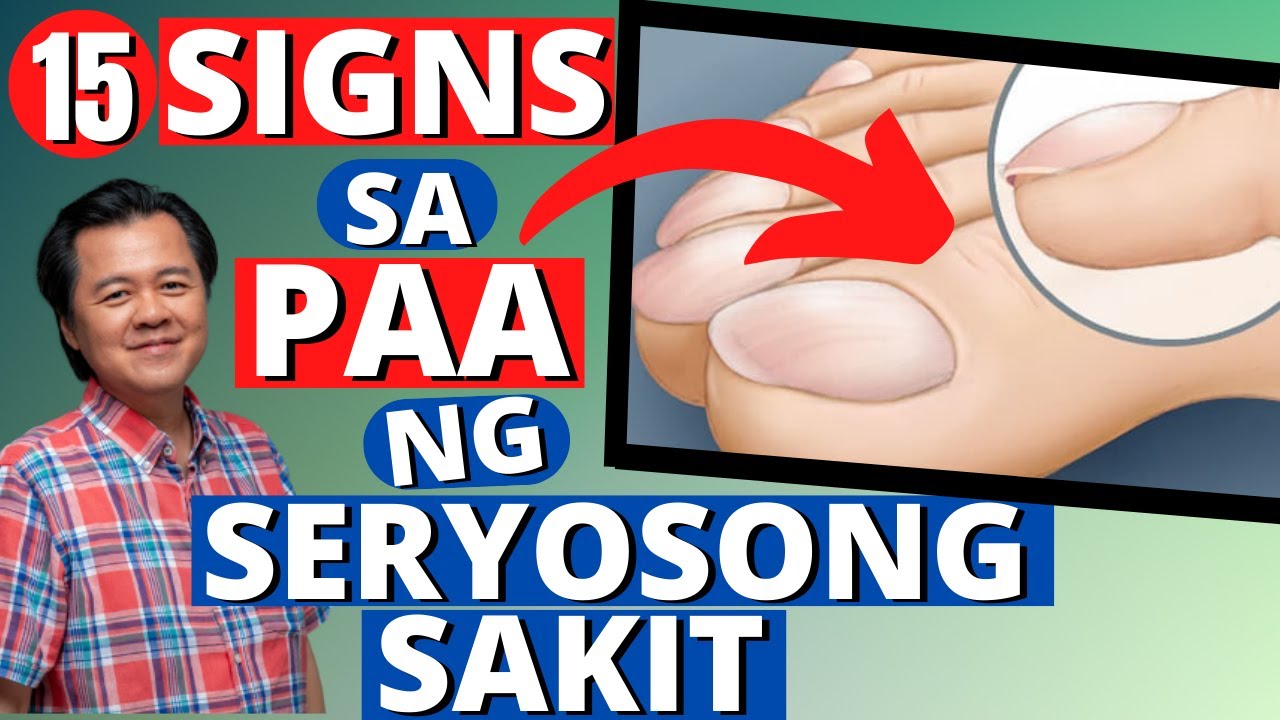 15 Signs sa Paa na may Seryosong Sakit. - By Doc Willie Ong (Internist and Cardiologist)