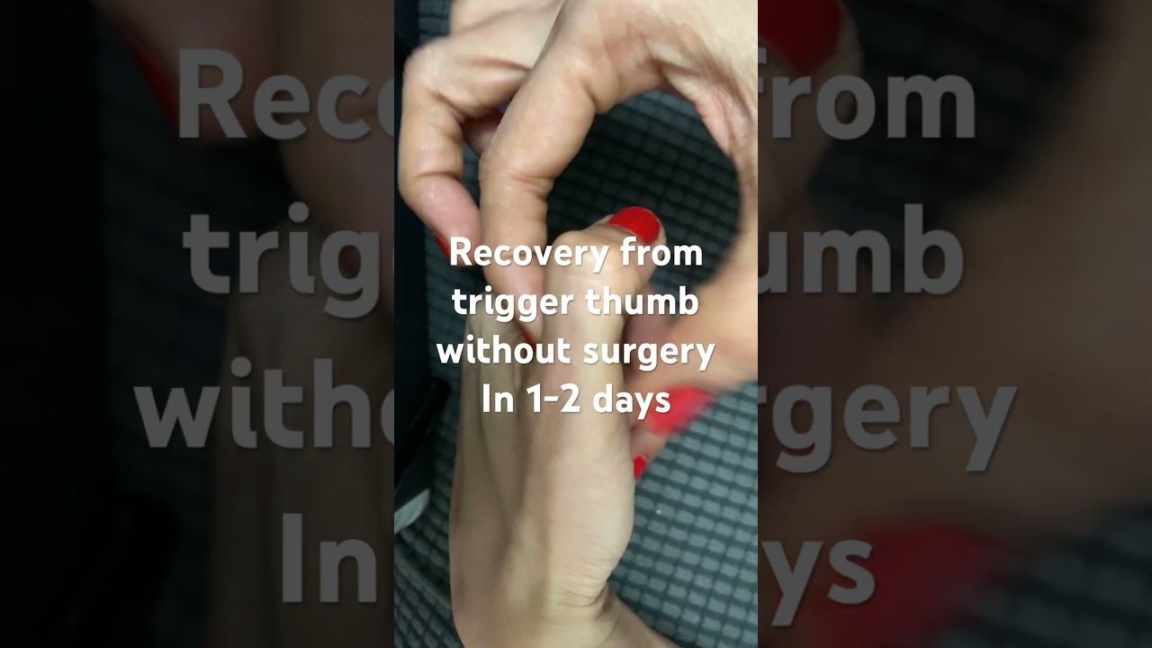 Easy powerful method Recovery from trigger thumb without surgery in 1-2 days