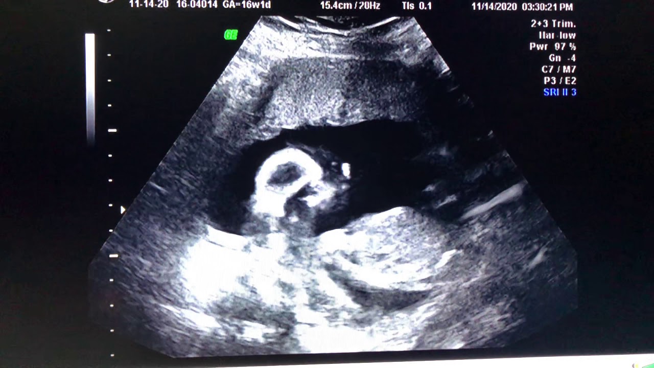 Baby Evelyn Adele-Gender Reveal!