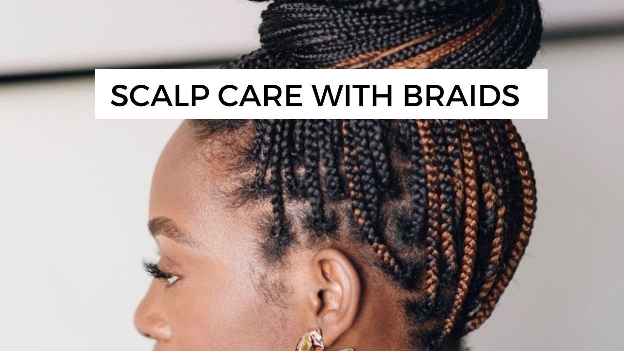 HOW TO TREAT DRY ITCHY SCALP WHILE WEARING BRAIDS | YoursTrulyYinka