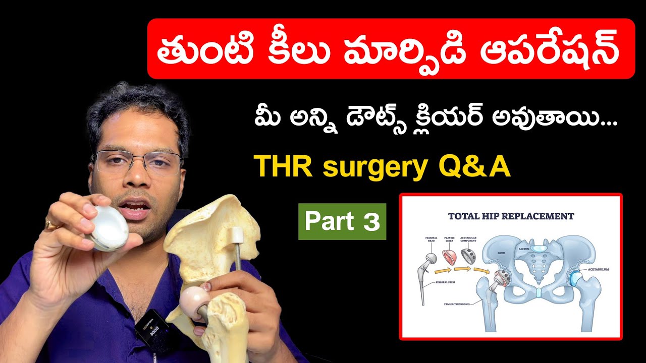 Hip Replacement FAQs Answered by Dr Ram Prasad | Dual Mobility, Uneven Legs, Foot Drop & More