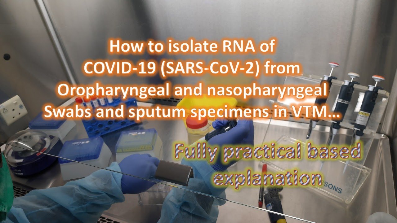 COVID-19 (SARS-COV-2) RNA Extraction for molecular tests