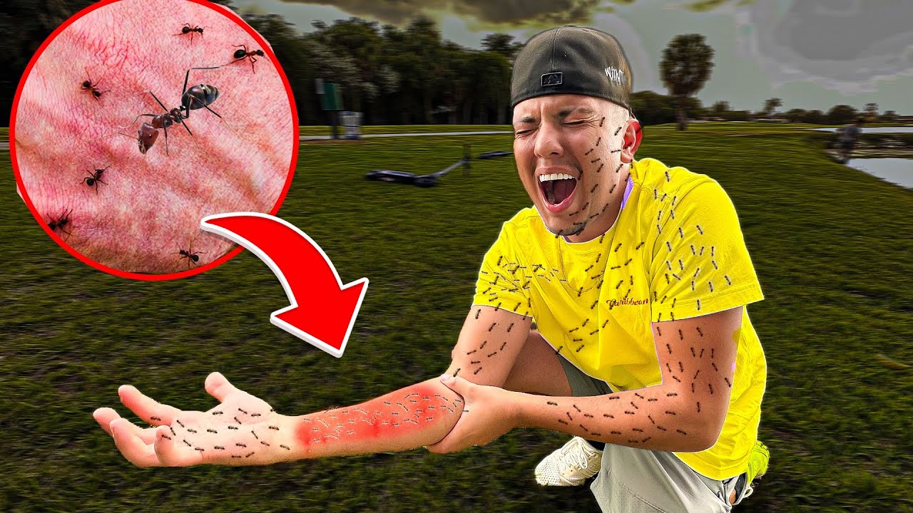 I Got ATTACKED By KILLER ANTS..