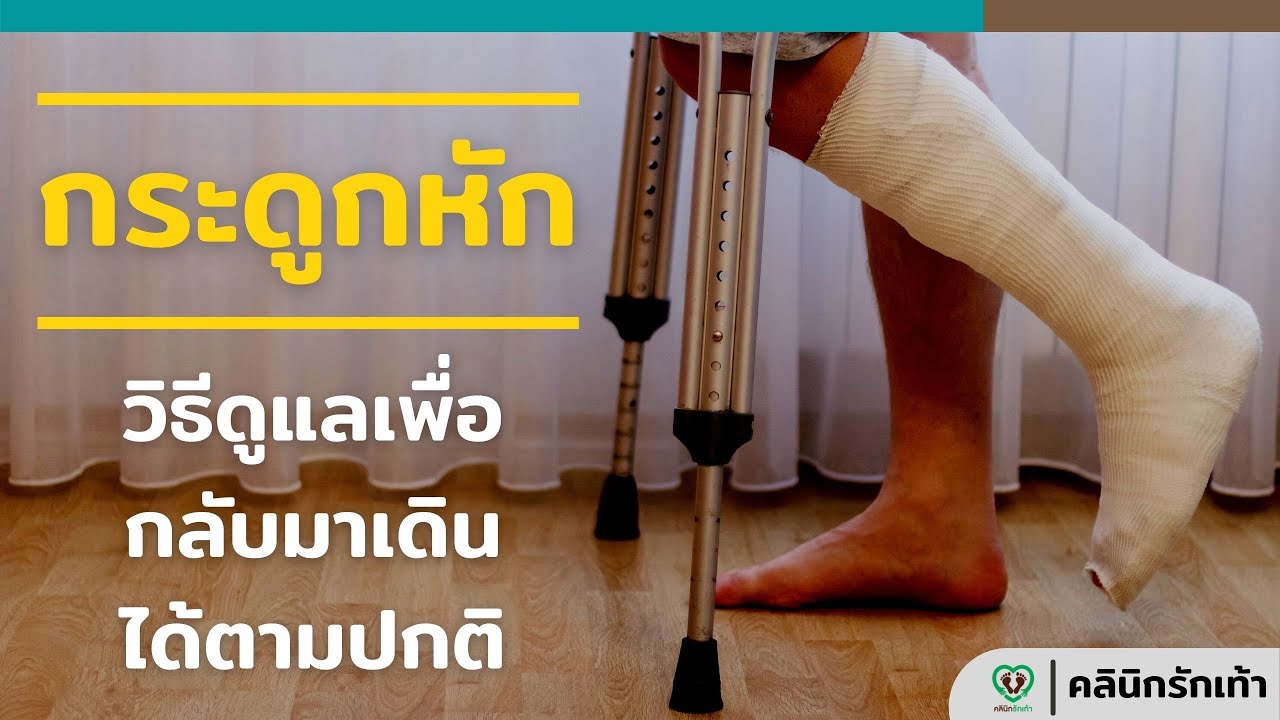 กระดูกเท้าหัก กระดูกขาหัก : วิธีการดูแล เพื่อให้กลับมาเดินได้เหมือนเดิม หรือใช้ชีวิตได้ตามปกติ