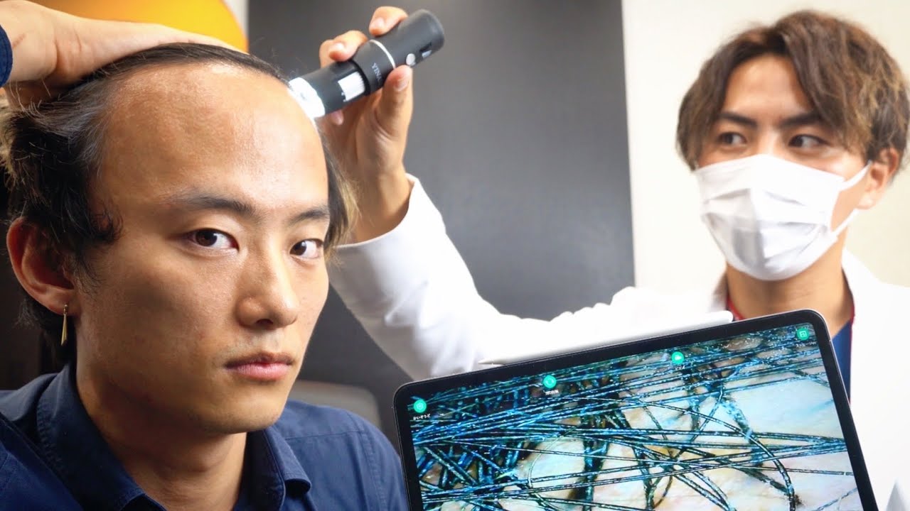 ハゲをお医者様にガチで診断してもらいました 。VLOG