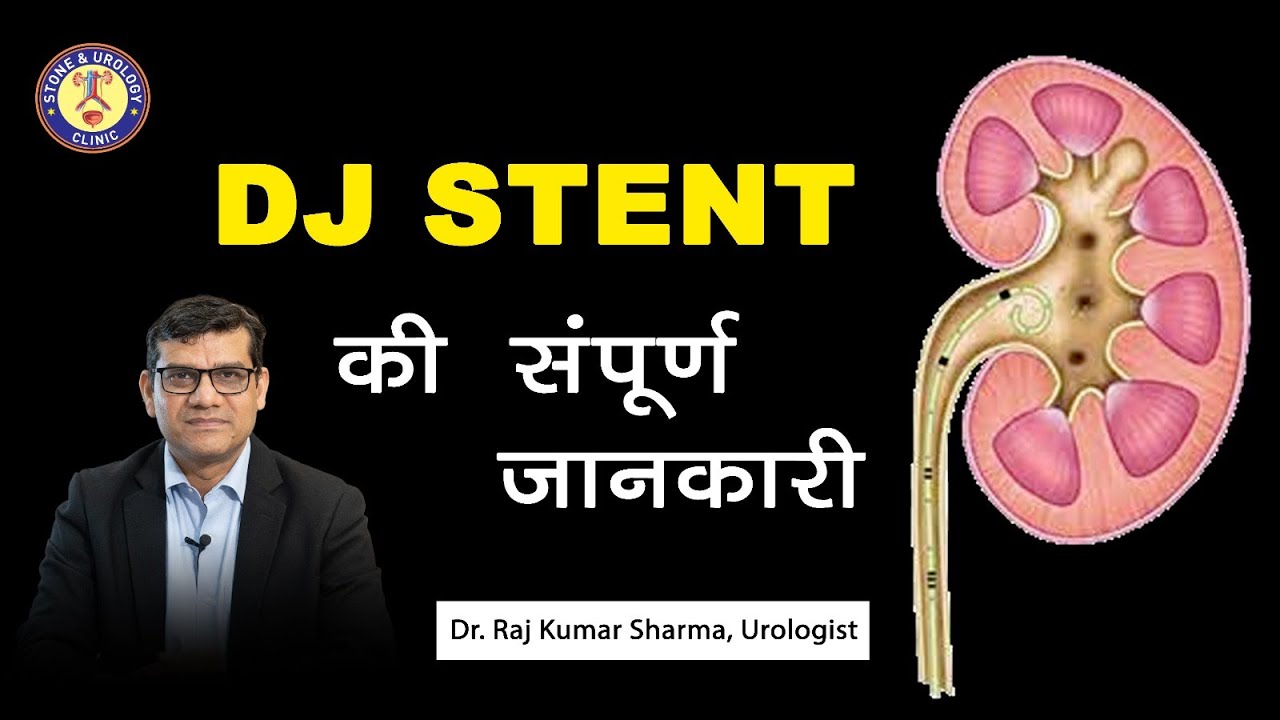 DJ Stent की संपूर्ण जानकारी!  क्या होती है? क्या फायदा होता है? और क्या side effects हो सकता है?