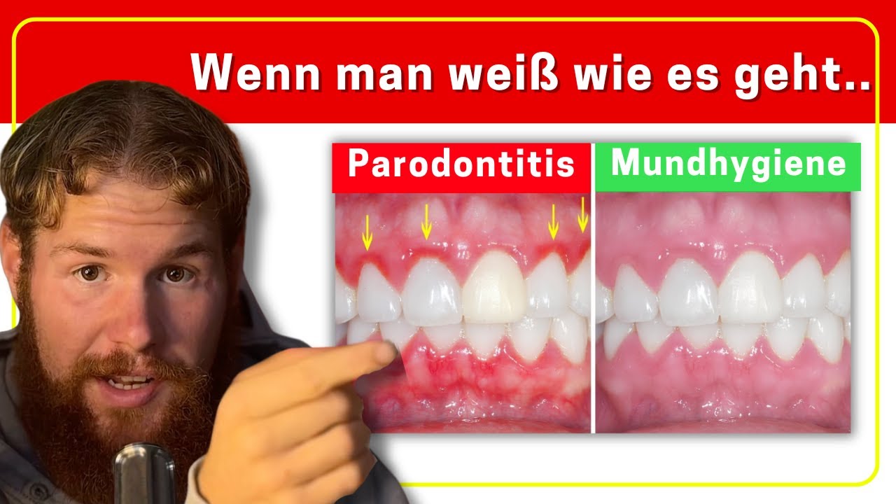 Wie ich meine Zähne & Zahnfleisch gerettet habe (7-Schritte Methode)