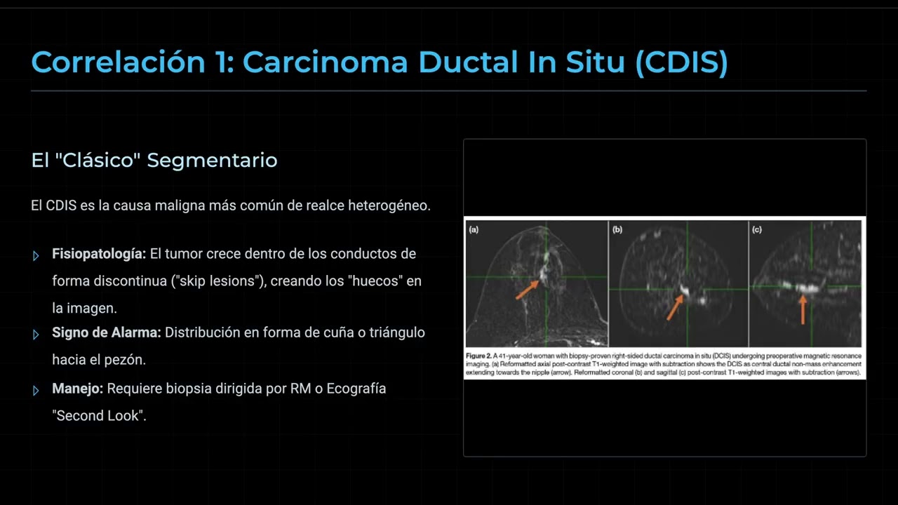 PATRON DE REALCE HETEROGENEO