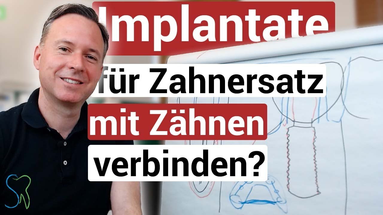 Kann man Implantate für Zahnersatz mit Zähnen verbinden?