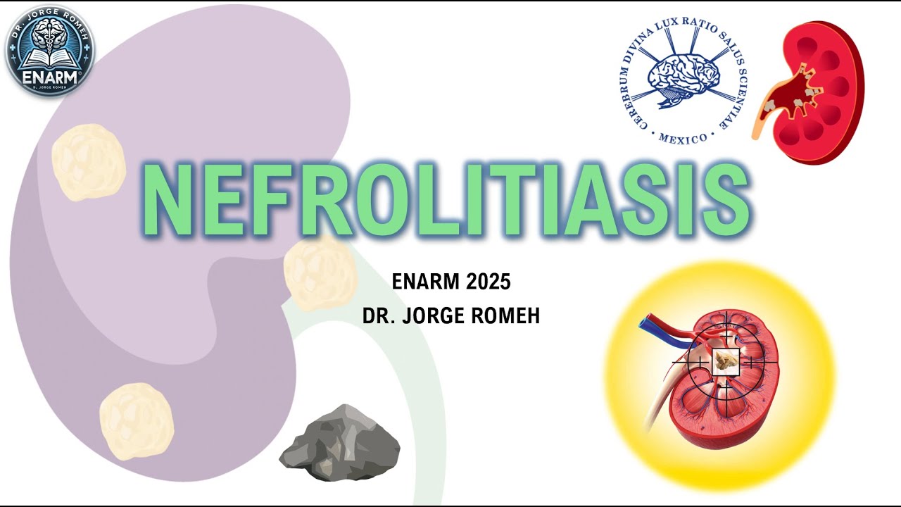 NEFROLITIASIS - COLICO RENOURETERAL - ENARM 2025 - TODO LO QUE DEBES SABER