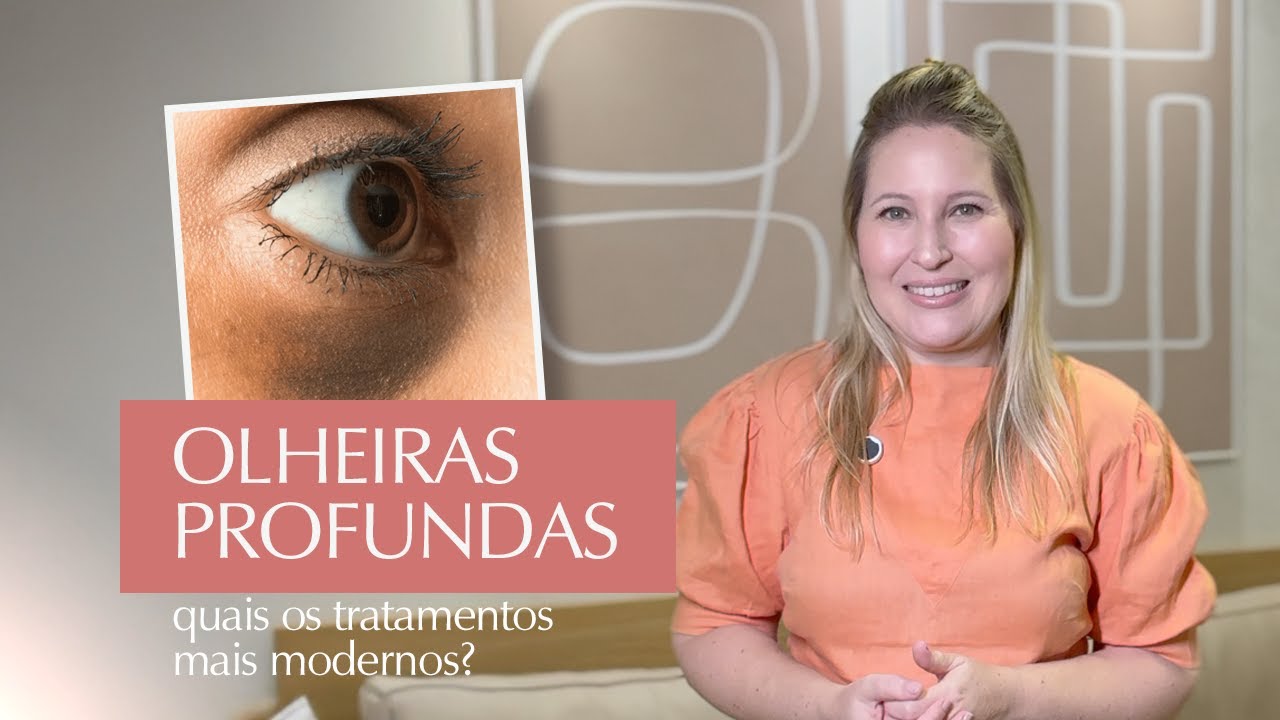 Olheiras Profundas: Causas, Tratamentos e Como Amenizar