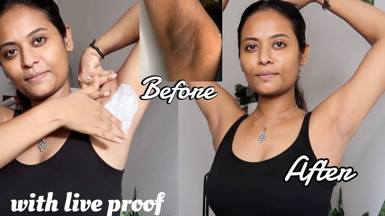 Home remedies to whiten your underarm in 1 ues with Live proof | topnotch beauty tips