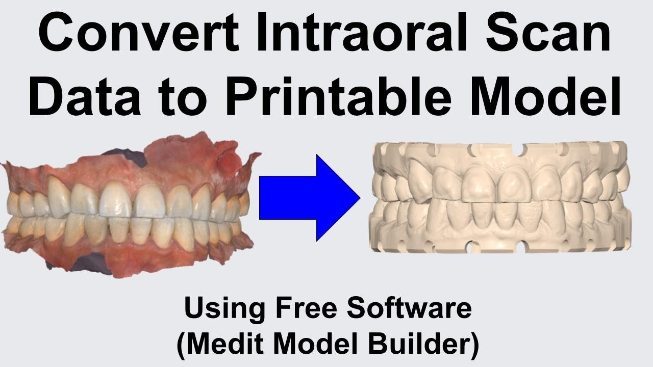 How to convert Intraoral Scan to 3D printed model using free Software (Medit Model Builder)