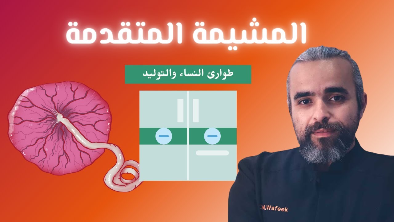توقف حركة الجنين كانت سبب في إنقاذ حياتها - د. محمد وفيق