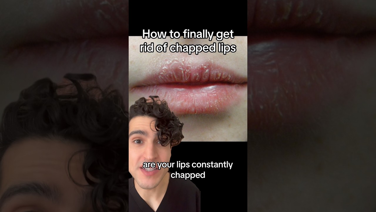 Dermatologist: how to finally fix chapped lips #chappedlips #lipcare #lipcareroutine #dermatologist
