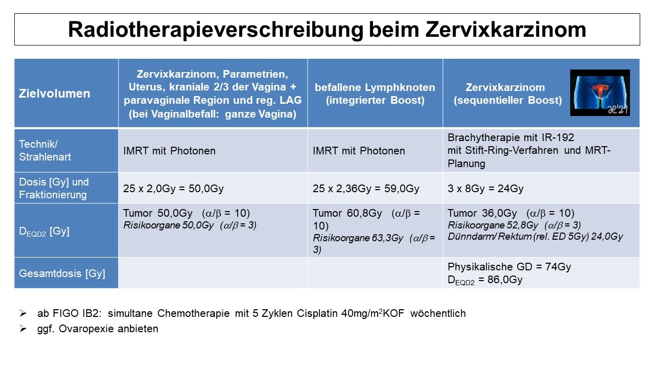 Radiotherapieverschreibung beim Zervixkarzinom | Strahlentherapie Prof. Hilke Vorwerk