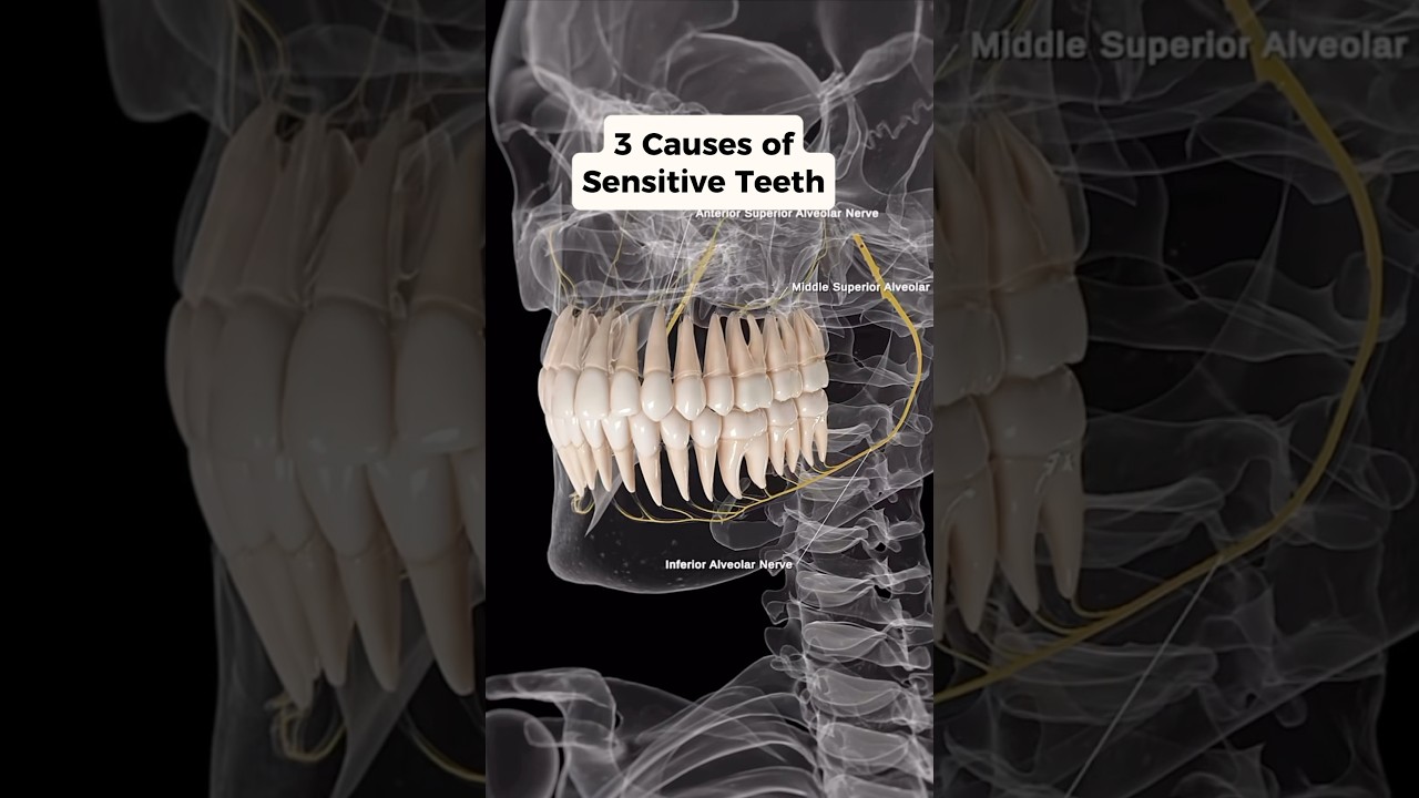 Did you know these are 3 common causes of SENSITIVE Teeth? Watch to find out! #teeth #tmj #neckpain